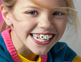 Invisalign®  Stickables